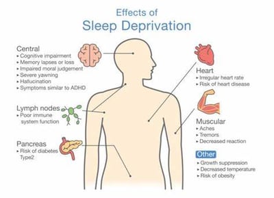 Effects of sleep deprivation