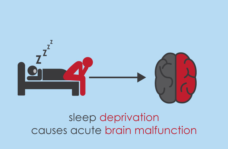 Sleeping brains. Сон и мозг. Sleep Deprivation Attack: схема.
