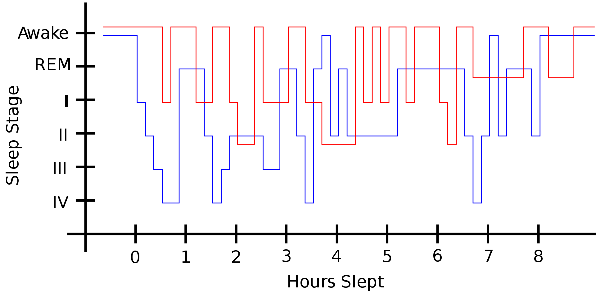 Restless leg syndrome sleep vs normal sleep.svg