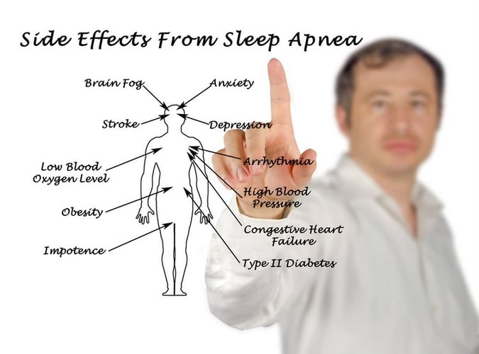 Who is at Risk for Obstructive Sleep Apnea?